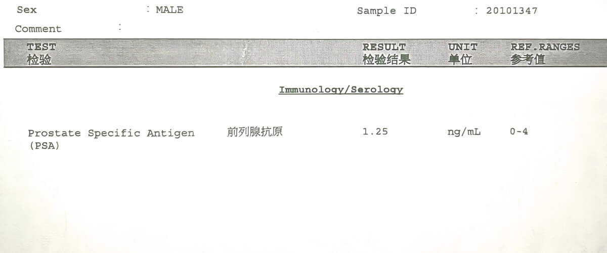psa on october 1, 2022, was 1.25 ng/mL i.e. normal