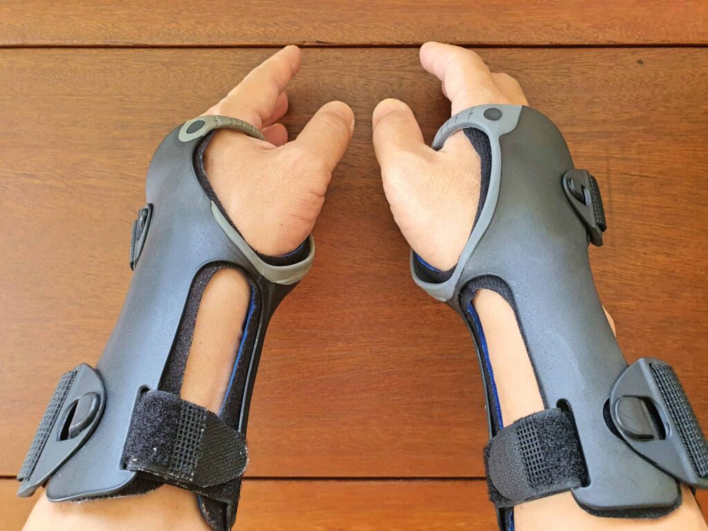 My 7-year-old Ossur Exoform Carpal Tunnel Wrist brace (left) and the one I recently purchased (right).