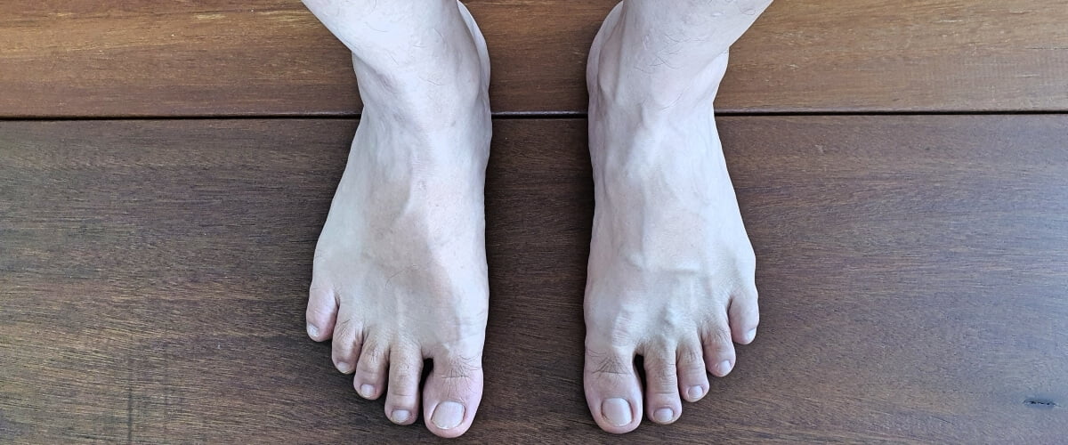 My feet, September 1, 2022